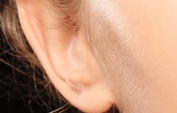 New York NY Ear Plastic Surgeon